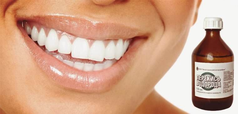 Как отбелить зубы перекисью водорода в домашних условиях без вреда эмали быстро и эффективно: рецепты и советы